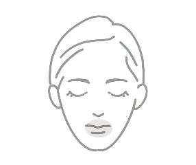 Cleft lip and palate